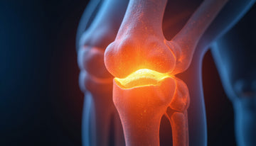 Cartilage loss: Proven Ways to Stop Pain and Rebuild Mobility
