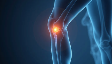 Viscosupplement formulation essentials: optimize knee pain relief and mobility