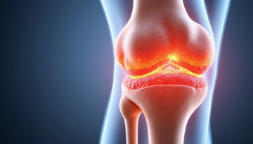 Hemarthrosis: How to Spot, Treat, and Prevent Joint Bleeding