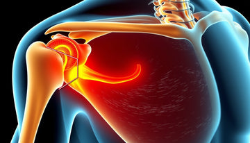 Understanding How Ultrasound Reveals Infraspinatus Tendinosis: Key Insights and Implications