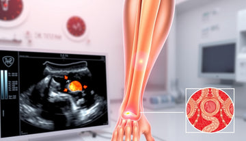 Understanding Ultrasound Results: What Severe Tendinosis Means for Your Health