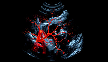 Understanding Ultrasound Shows Neovascularization: Key Insights and Implications for Your Health