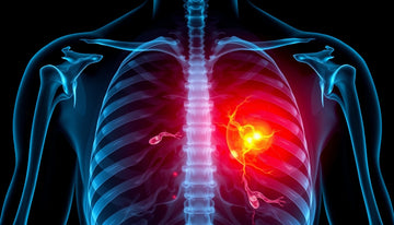 Understanding X-Ray Results: What Chronic Changes Really Mean for Your Health