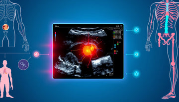 Understanding Ultrasound: What a Nerve Compression Appearance Indicates for Your Health