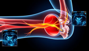Unlocking the Mystery: Understanding Ultrasound Findings in Cubital Tunnel Syndrome