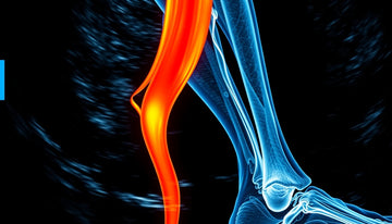 Understanding Posterior Tibial Tendinosis: Insights from Ultrasound Imaging